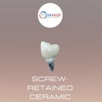 screw-retained ceramic